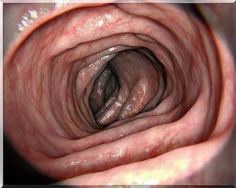 Parts of the large intestine