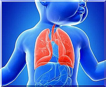 Causes of bronchiectasis