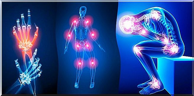 joint pain and collagen for its treatment