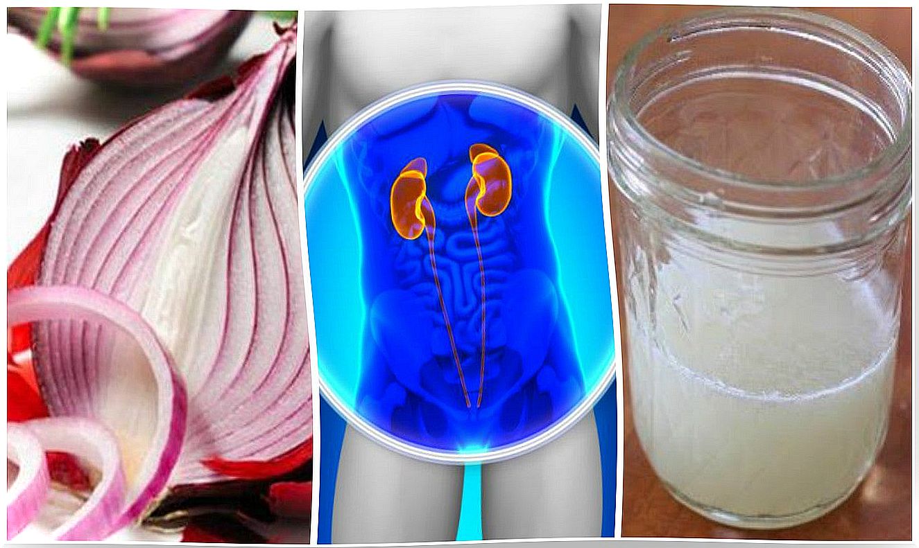 How to prepare an onion remedy to cleanse the kidneys