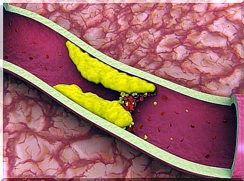 Juices to lower cholesterol