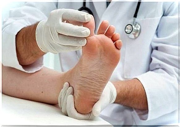 Natural ways to remove athlete's foot