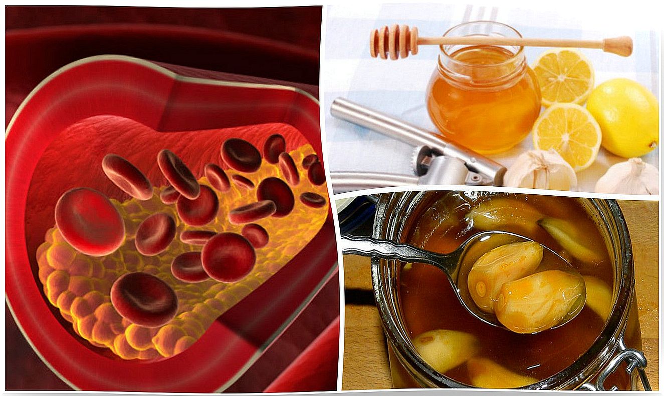 Lower your cholesterol levels with a natural remedy