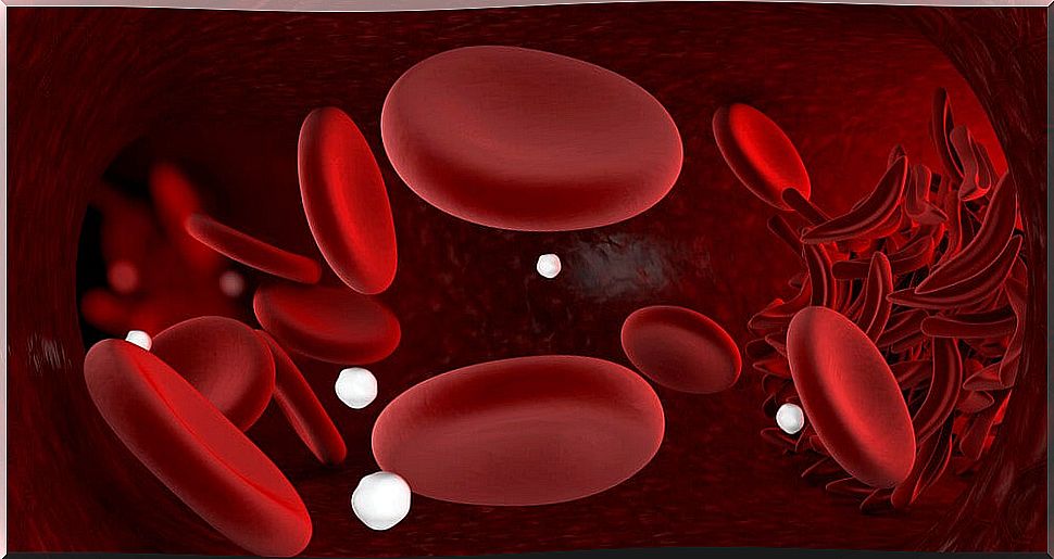 Genetics and sickle cell anemia