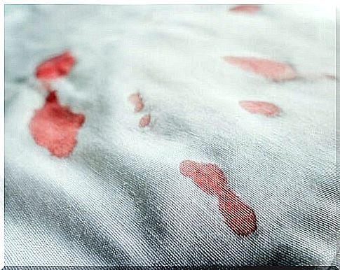 clothes with blood stains